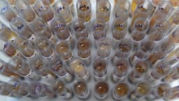 Tubos de teste para diagnóstico de malária em laboratório do Hemoam, em Manaus, foto de arquivo