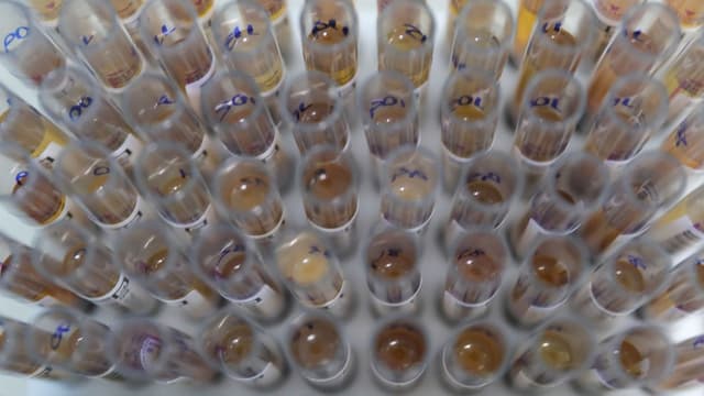 Tubos de teste para diagnóstico de malária em laboratório do Hemoam, em Manaus, foto de arquivo