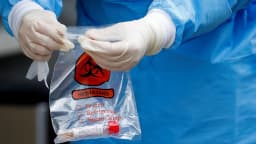 Profissional de saúde manuseia saco de biossegurança com amostra biológica
