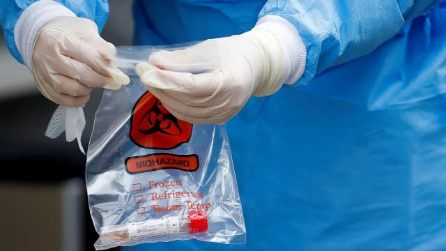 Profissional de saúde manuseia saco de biossegurança com amostra biológica