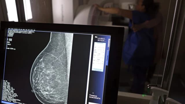 Paciente realiza exame de imagem em unidade do SUS