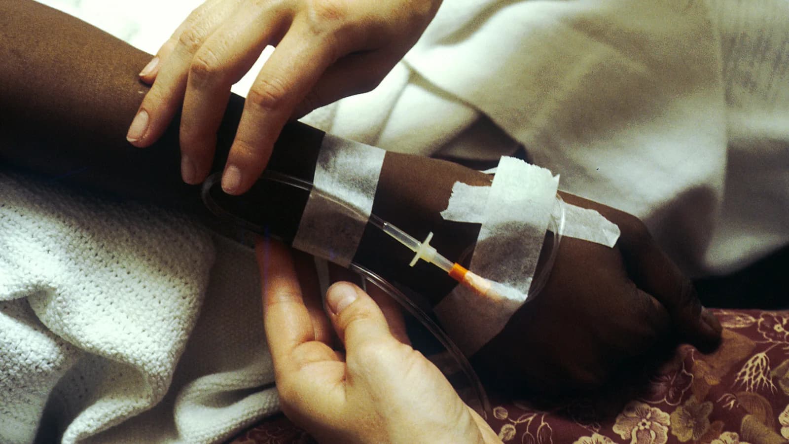 Mãos de paciente recebendo quimioterapia por via intravenosa