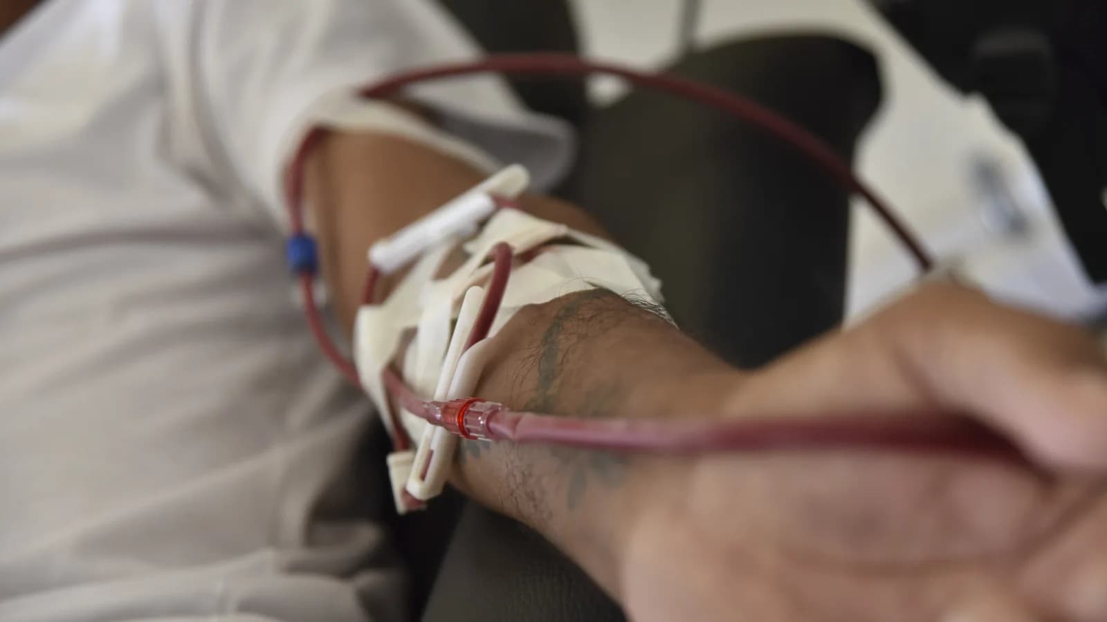 Braço de paciente recebendo infusão intravenosa em ambiente hospitalar