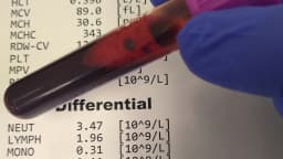 Resultado de hemograma completo ao lado de tubo de coleta de sangue