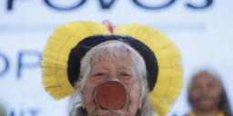 Cacique Raoni tem hemorragia digestiva, mas quadro é estável — Assuntos: Cacique Raoni, internado, Hospital da Unifesp, hemorragia digestiva, estômago, duodeno