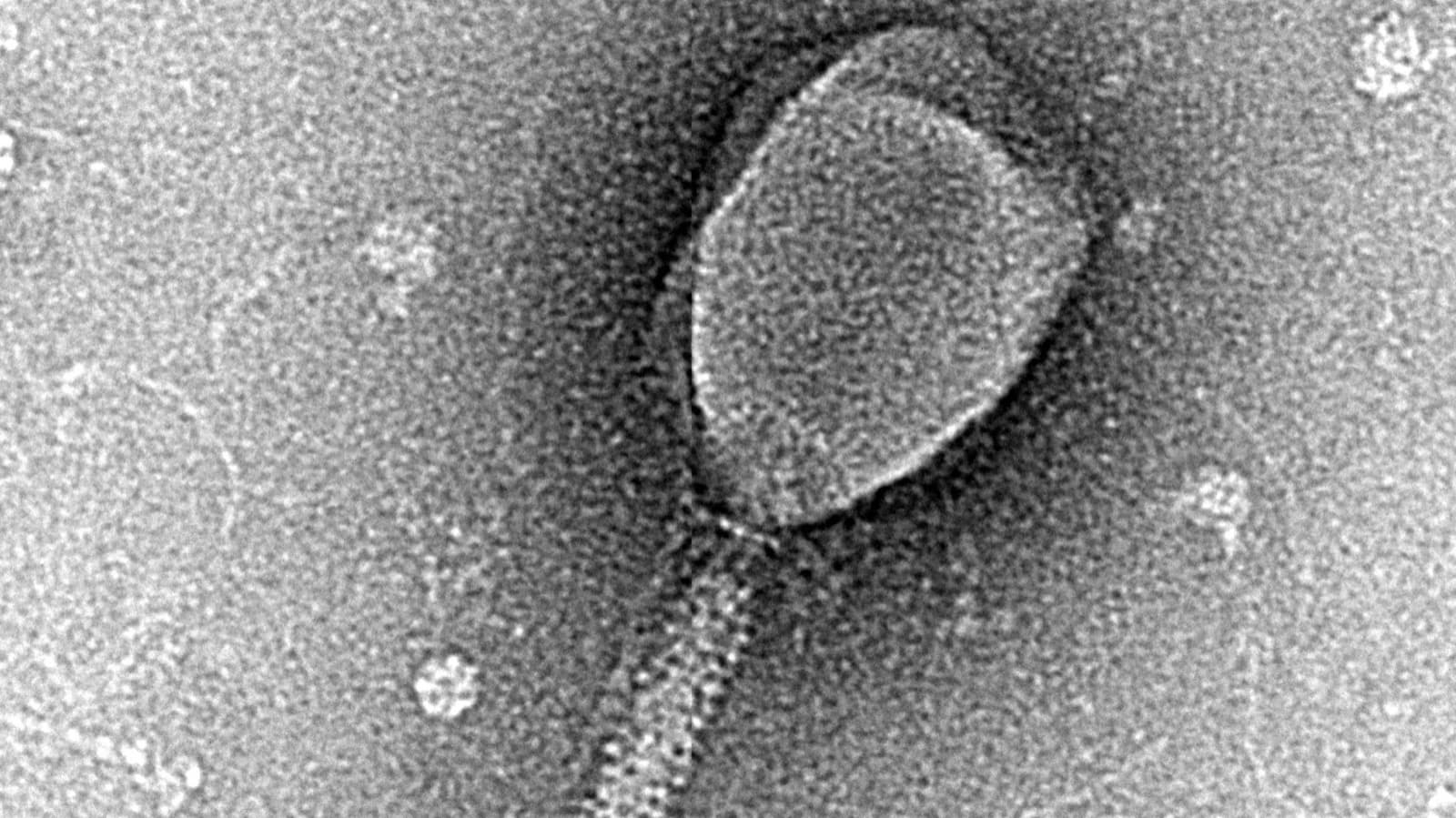 Micrografia eletrônica de um bacteriófago real, vírus que infecta bactérias (imagem ilustrativa)