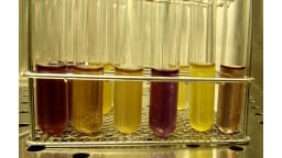 Tubos de ensaio com amostras coloridas em análise microbiológica de laboratório (foto ilustrativa)