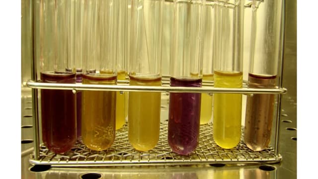 Tubos de ensaio com amostras coloridas em análise microbiológica de laboratório (foto ilustrativa)