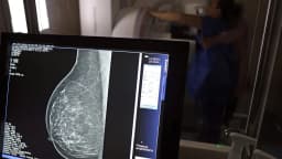 Mamografia sendo realizada em mulher, com imagem do exame exibida em monitor