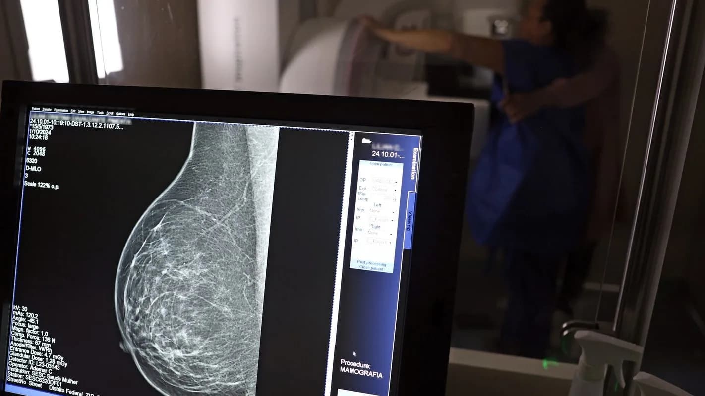 Mamografia sendo realizada em mulher, com imagem do exame exibida em monitor