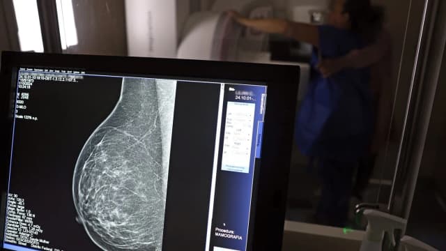 Mamografia sendo realizada em mulher, com imagem do exame exibida em monitor