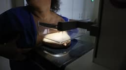 Paciente realiza exame de mamografia em equipamento hospitalar