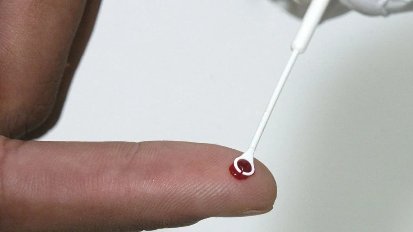 Exame de sangue em imagem de arquivo usada como contexto para pesquisa sobre HTLV-1