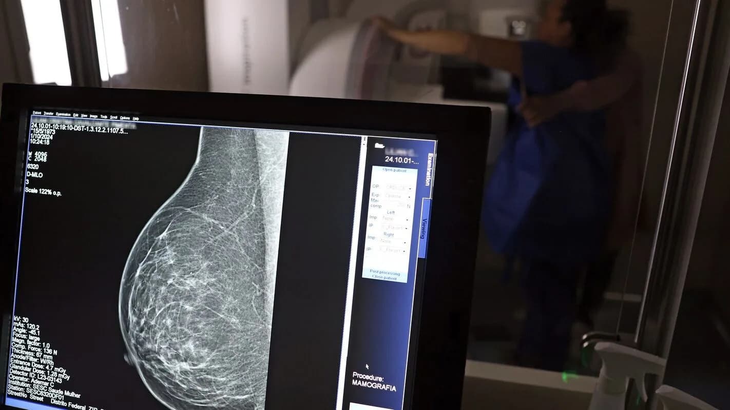 Tela exibe imagem de mamografia durante atendimento de saúde, em registro de arquivo de outubro de 2024.