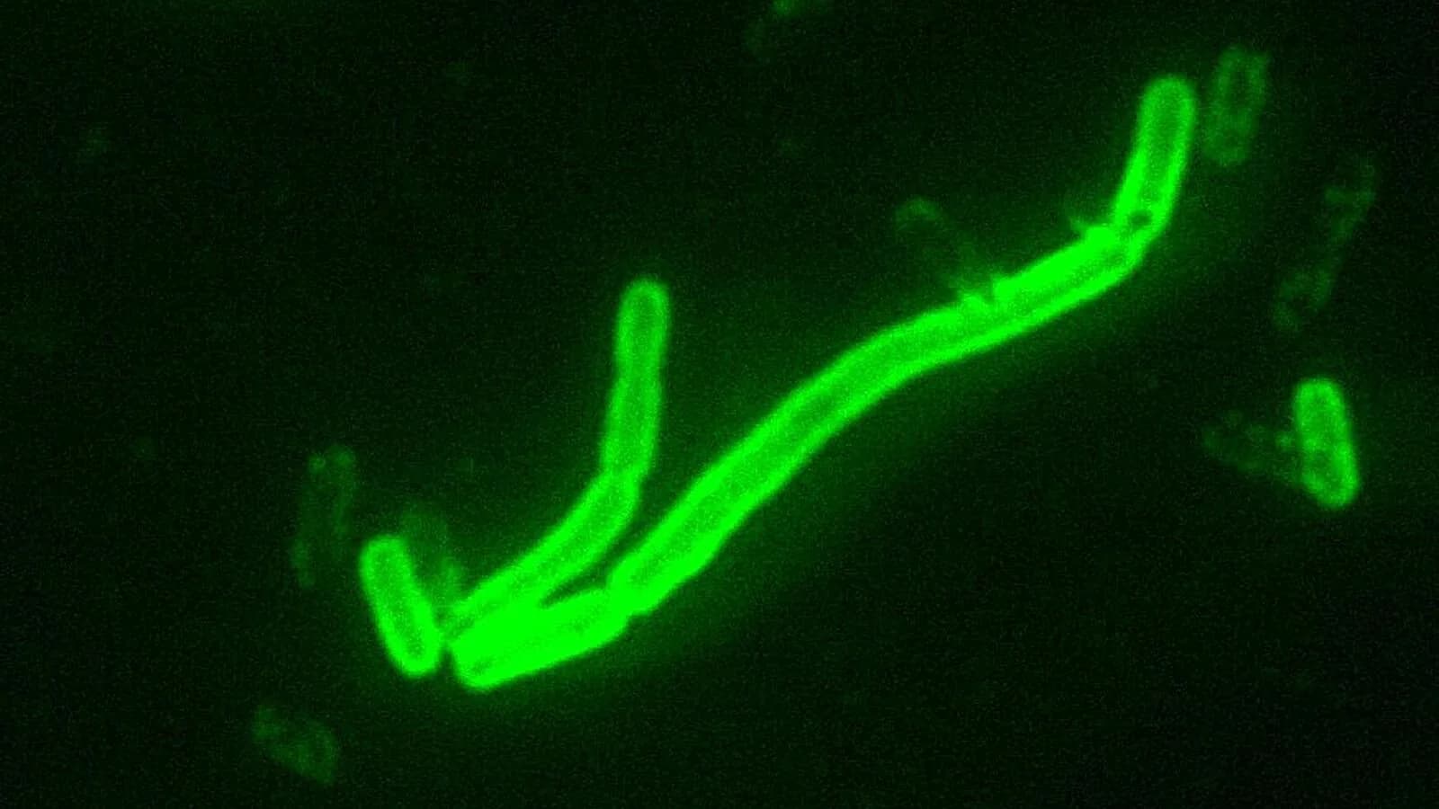 Bactéria Yersinia pestis, causadora da peste, vista em microscopia de fluorescência