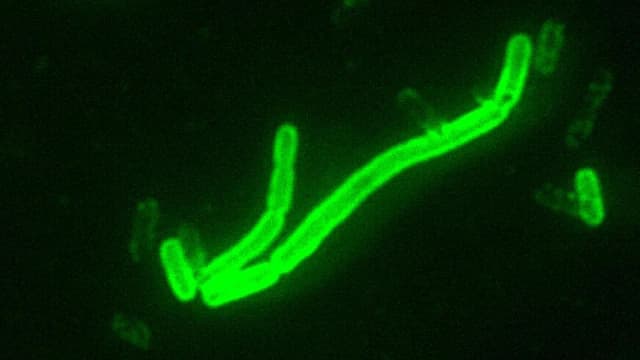 Bactéria Yersinia pestis, causadora da peste, vista em microscopia de fluorescência