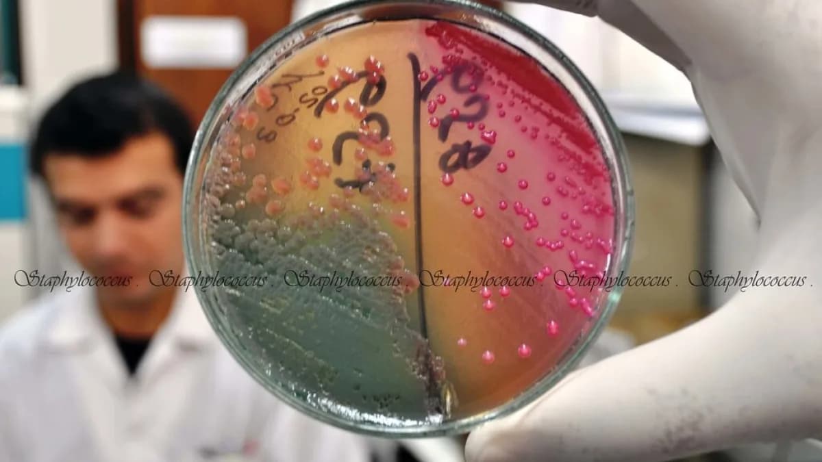 Cientista em laboratório examina placa de cultura de bactérias