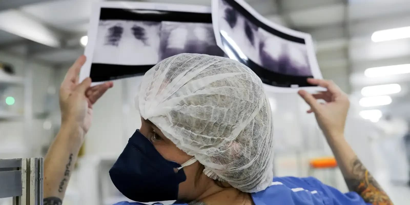 Profissional de saúde analisa radiografias de tórax em hospital
