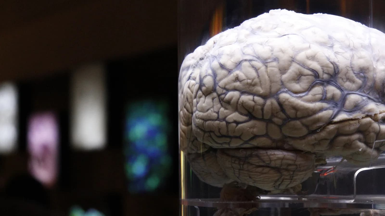 Cérebro humano exibido em exposição científica, mostrando detalhes do córtex