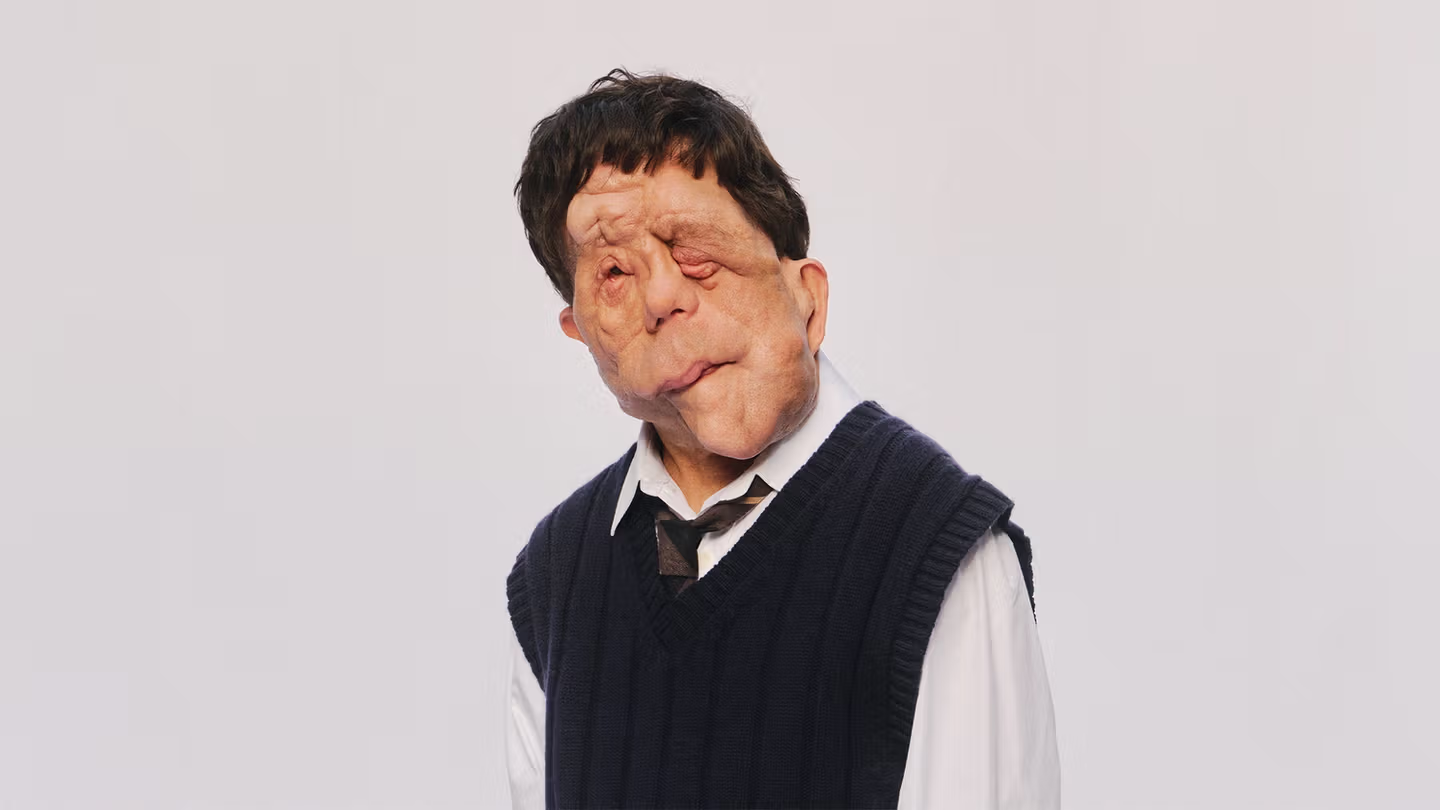 'O Homem Elefante' ganha nova adaptação para os cinemas com Adam Pearson